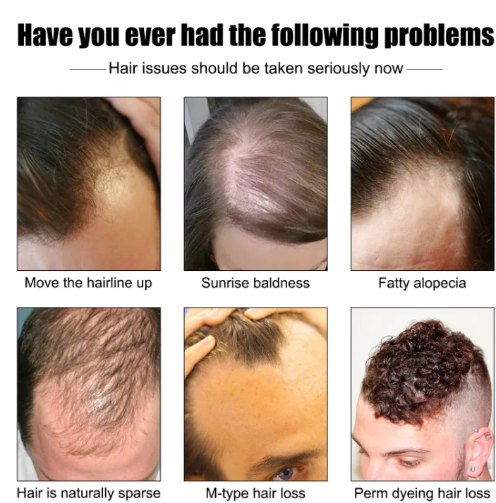 Men's Hair Growth Essence